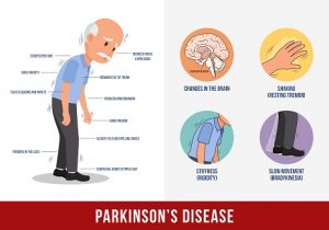 Vector of Parkinson's Disease Symptoms.